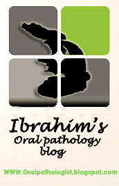 Ibrahim's oral pathology blog
