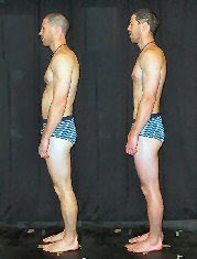 Before and After Series