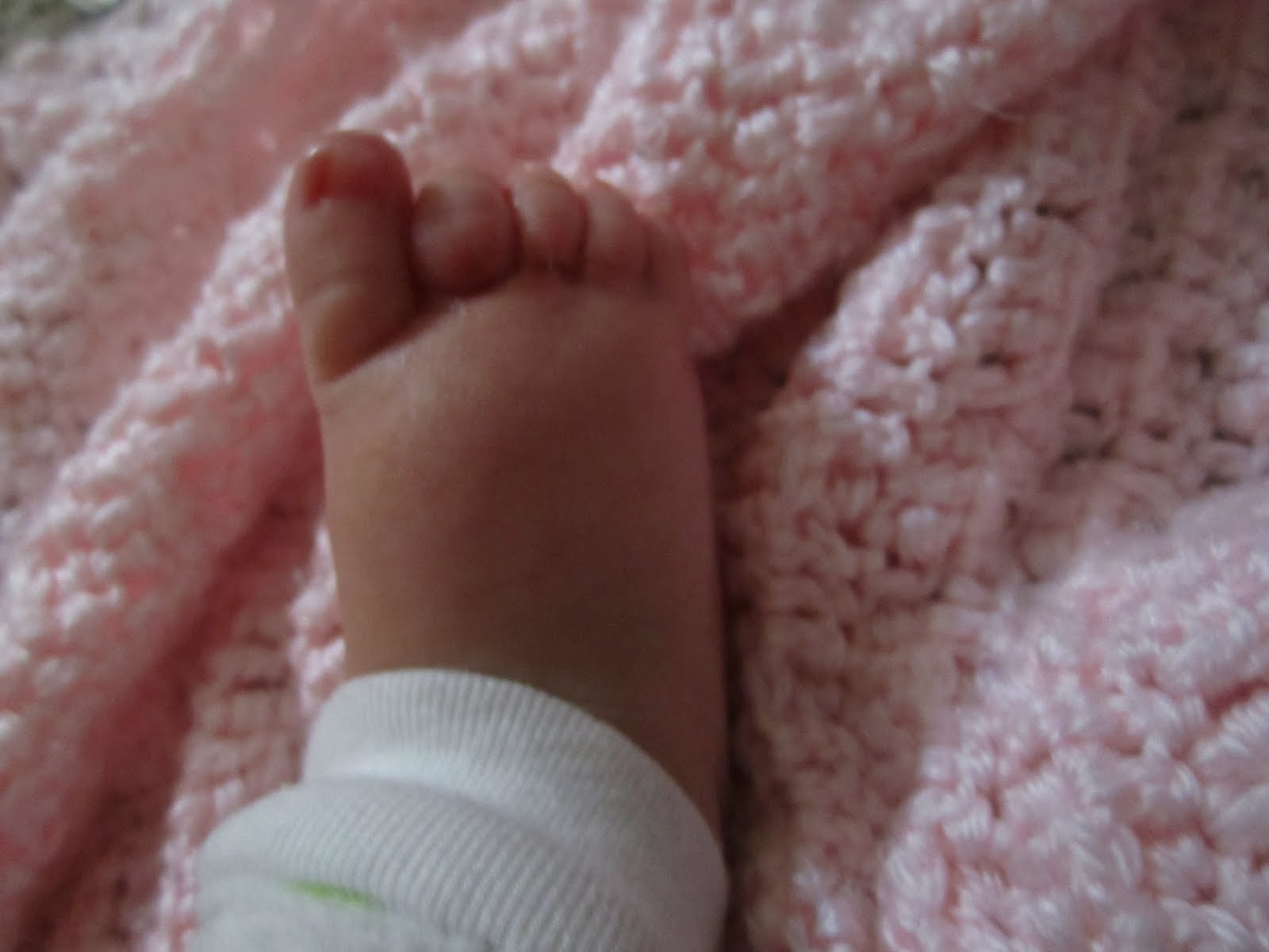 5 in 5 Bring on the Blessings! Diagnosis Hair tourniquet