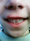 [dentes_jil.jpg]