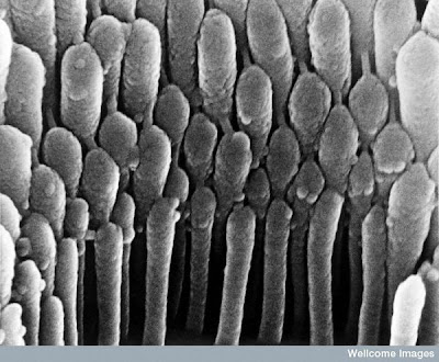 15 imágenes microscópicas del cuerpo humano. 4.+Hair+cell+in+the+ear