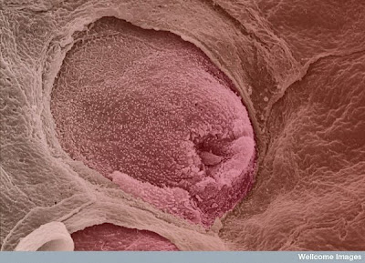 15 imágenes microscópicas del cuerpo humano. 6.+Tongue+with+taste+bud