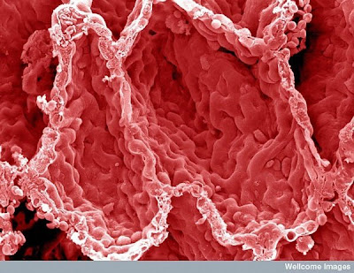 15 imágenes microscópicas del cuerpo humano. 9.+Alveoli+in+the+lung.