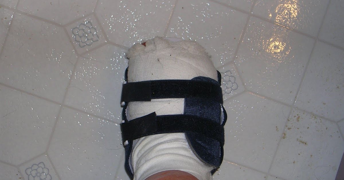 Quiltcat's Mewsings How to Take a Shower While Wearing a Surgical Boot