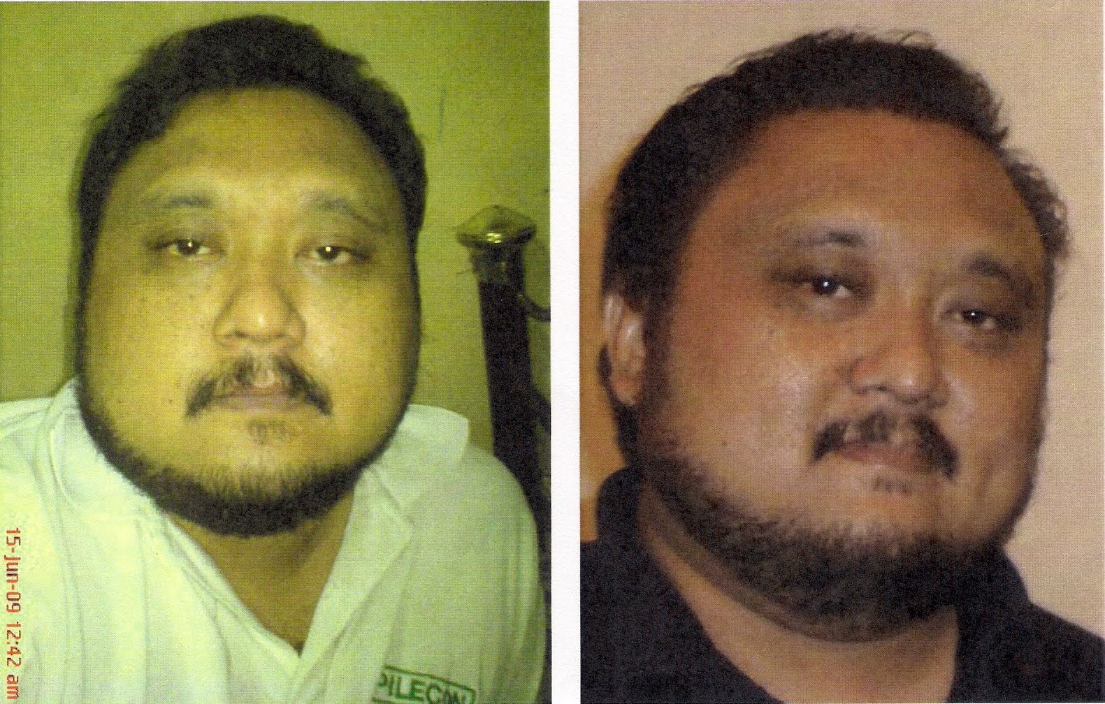 penyakit batu karang