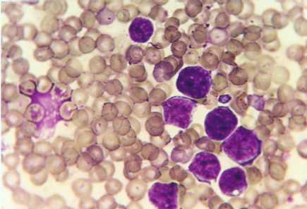 Virus pneumonie murine; Virus pneumonie, souris