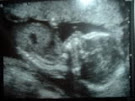 Kayleigh at 20 weeks