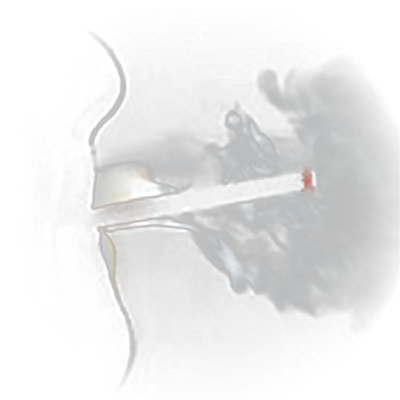 Sin Tabaco y Channel