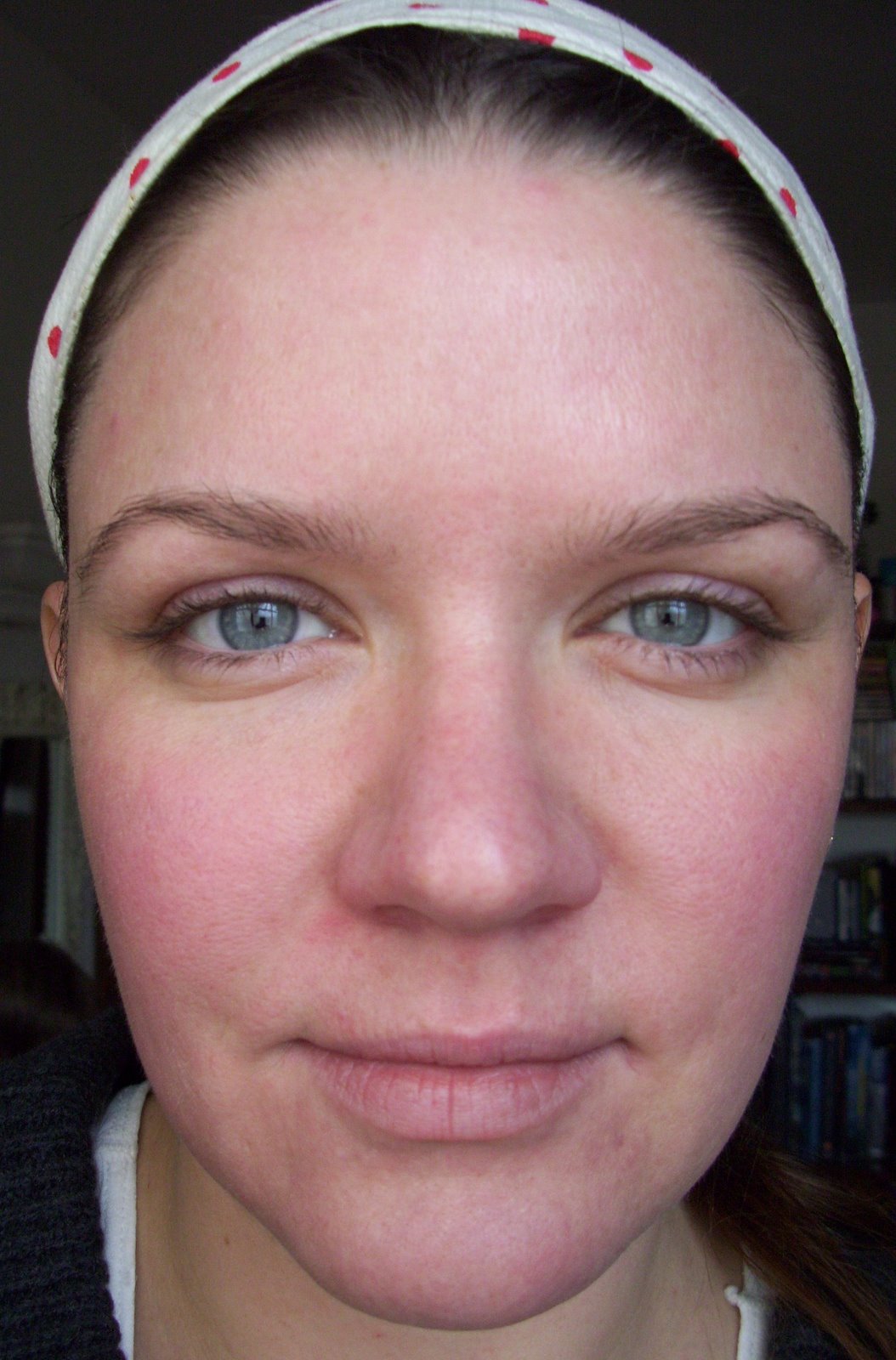 [Post+Pearl+After+Result+Full+Face.JPG]