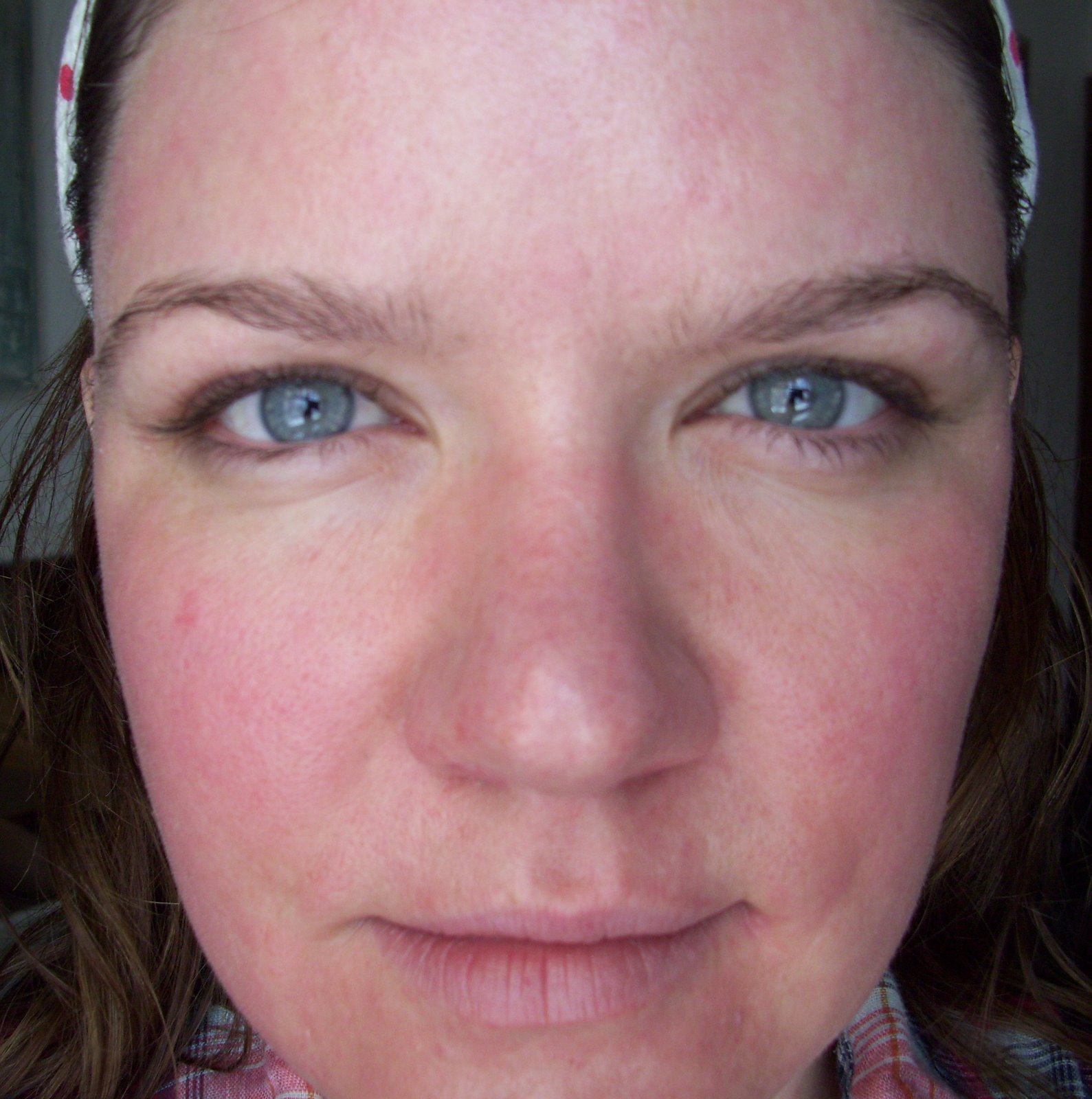 [Post+Pearl+Day+6+Full+Face+Close+Up.JPG]