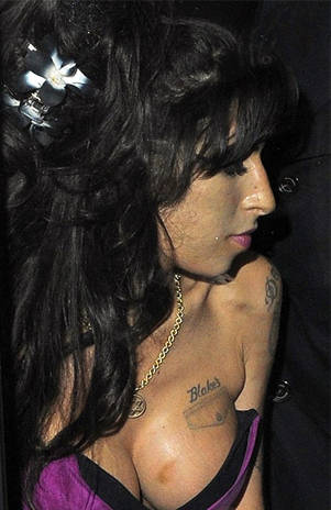 Amy Winehouse tiene una mancha en uno de sus senos