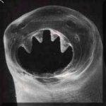 effects of hookworms in humans effects of hookworms in humans