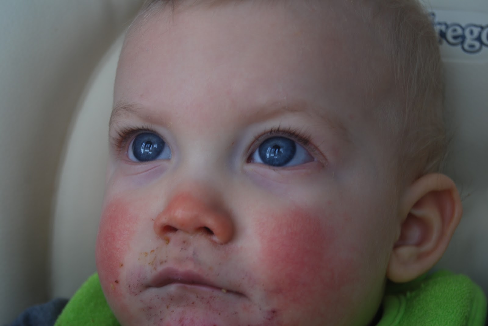 Team Studer runny noses and little toeses