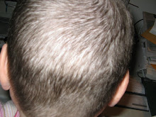No Eyes on The Back of my Head