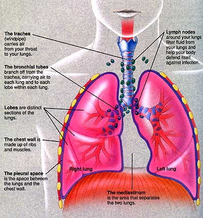 Lung Cancer Diagram
