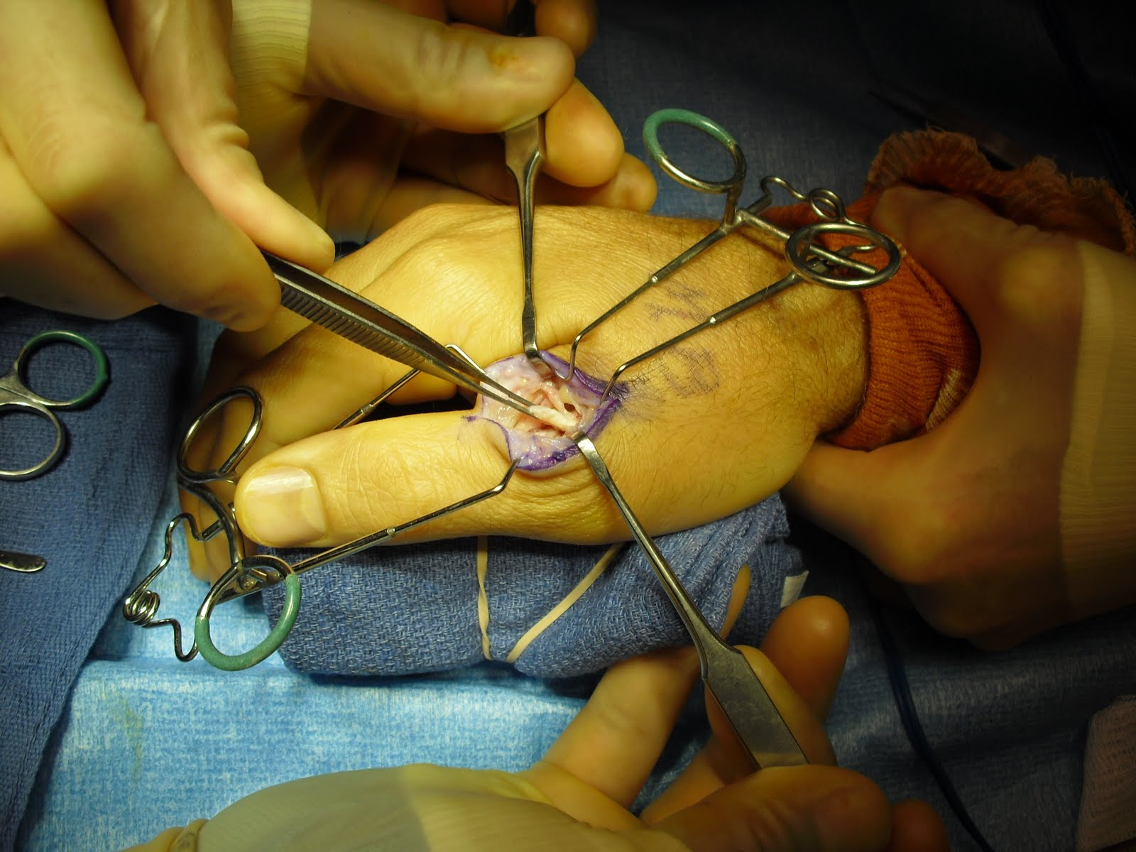 Ucl Surgery