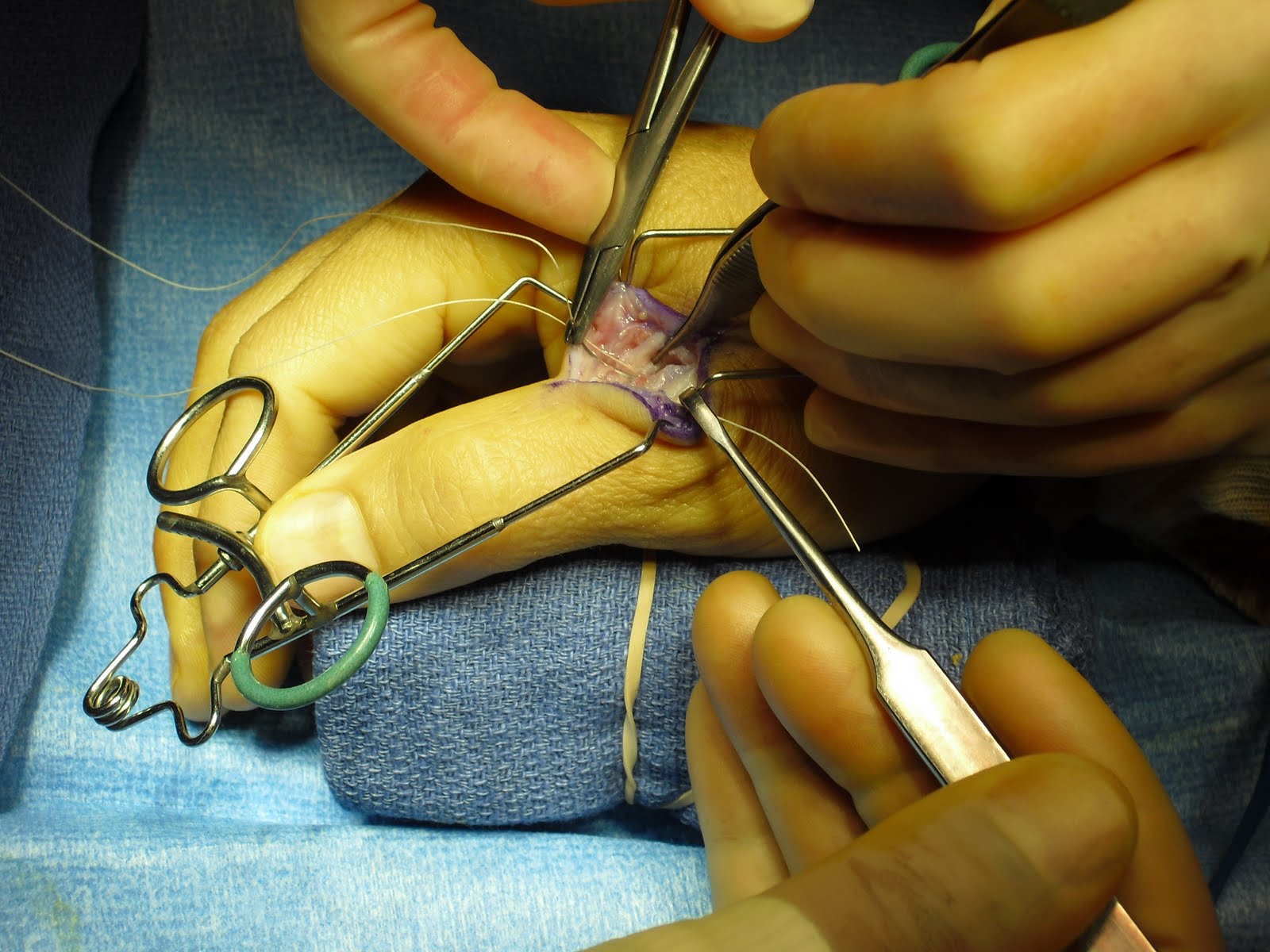 Ucl Surgery