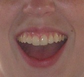 [smile+sm.jpg]