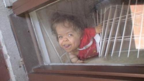 Deeny's Simple Joys Surviving with Thanatophoric