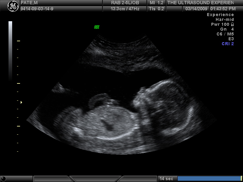 [OUR+BABY+GIRL+AT+20+WEEKS_32.JPG]