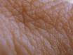 pori pori kulit manusia