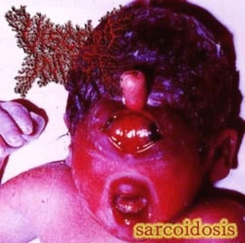 Album: Sarcoidosis Year: 2007