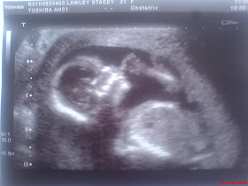 My Pregnancy Diary Long Time No Post 17 Weeks 5 Days Pregnant