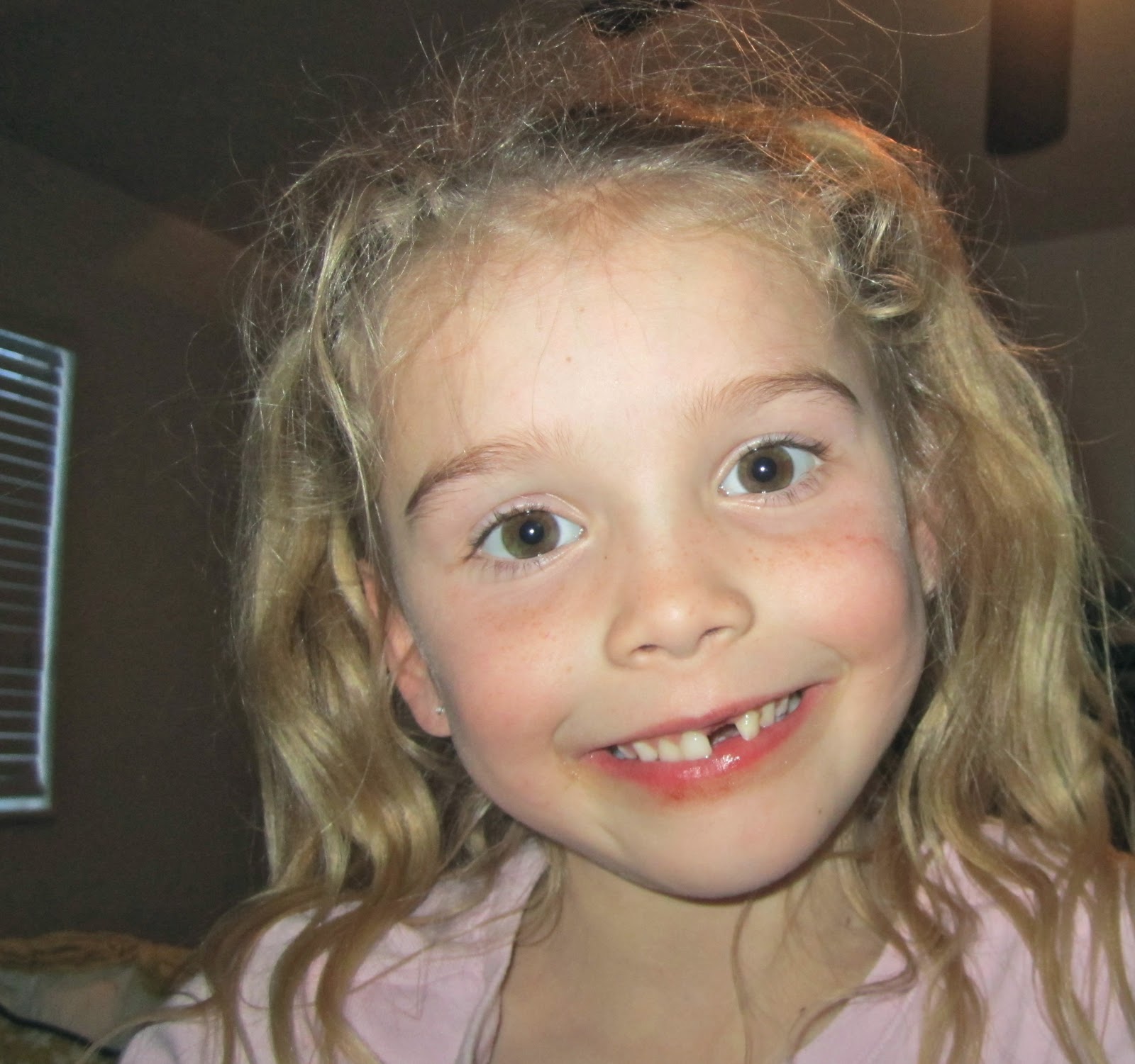 tooth lost missing mouth happy