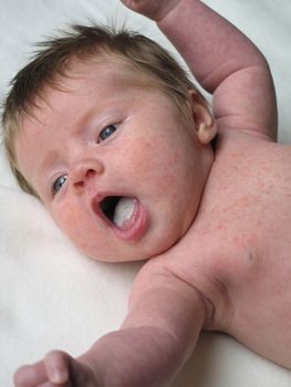 Treating Thrush