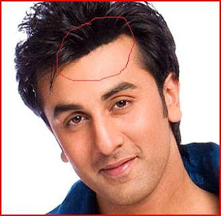 Bollywood Actresses, Movies, News, Songs: Bollywood Celebrities Plastic