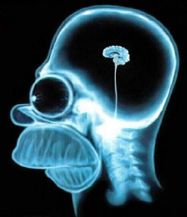 [brain.jpg]