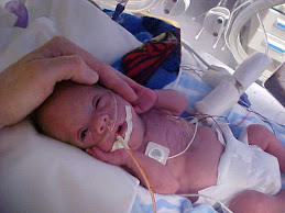Braden