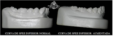 Curva De Spee