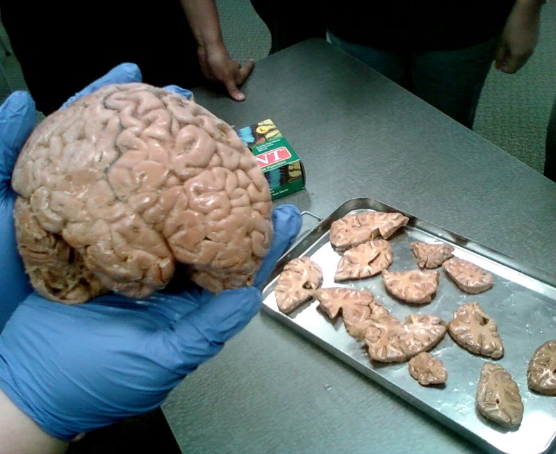 Human Brain Real