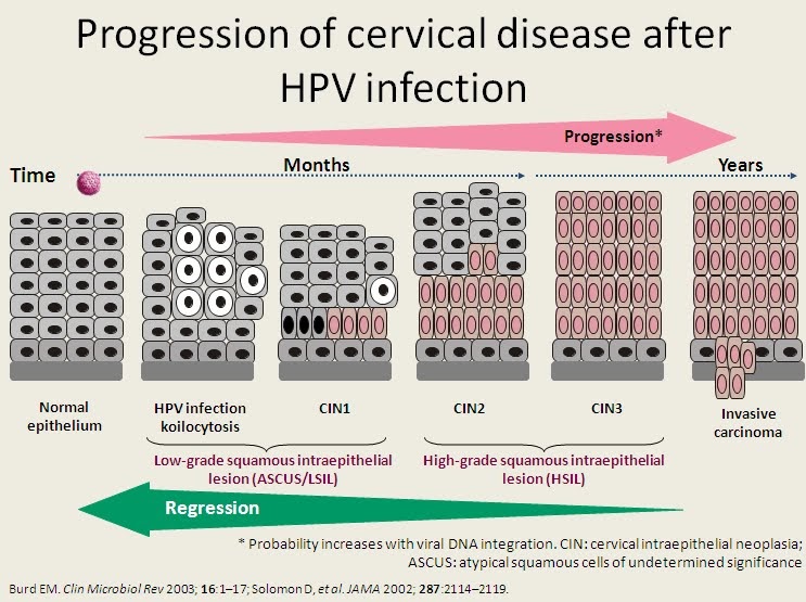 SHJ Women's Health Specialist Progression of Cervical Disease after