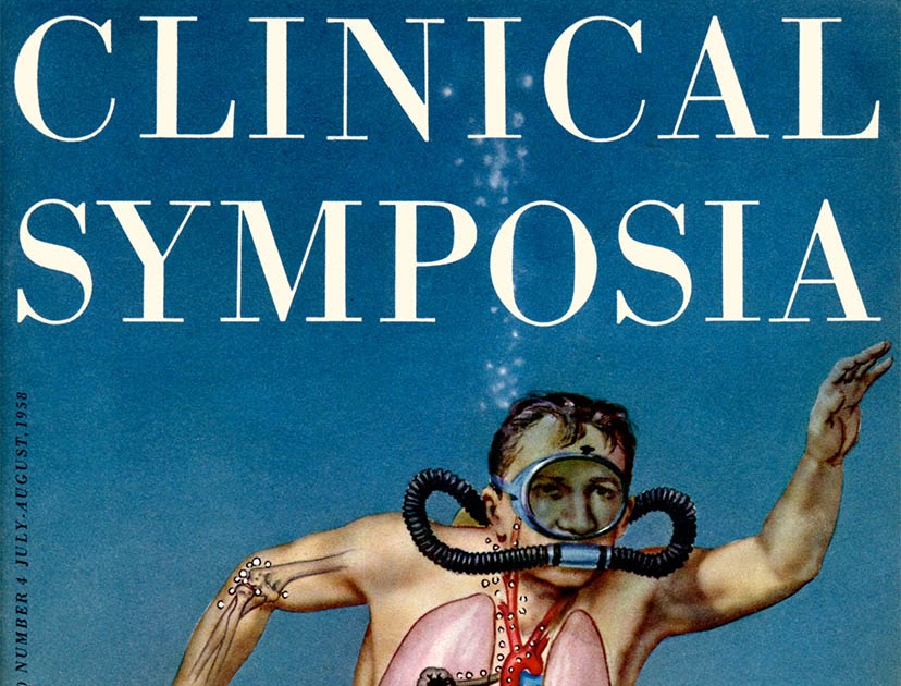 Living Vicariously Thru Other People's Art Anything Frank Netter