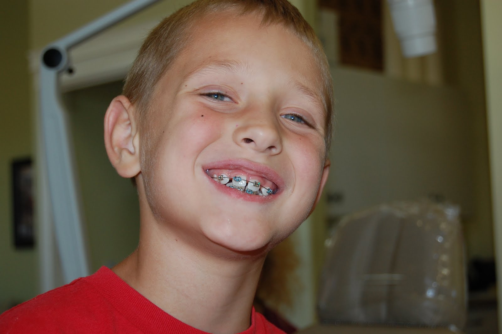 Life in the Peanutbutter Lane Braces Day