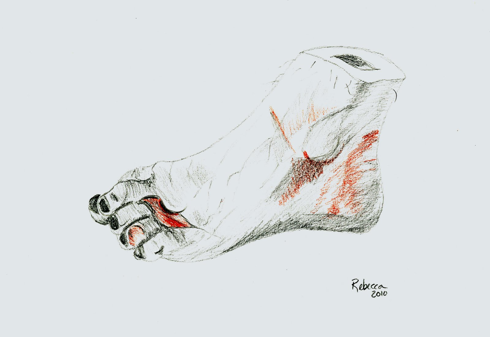 Gangrene Cartoon
