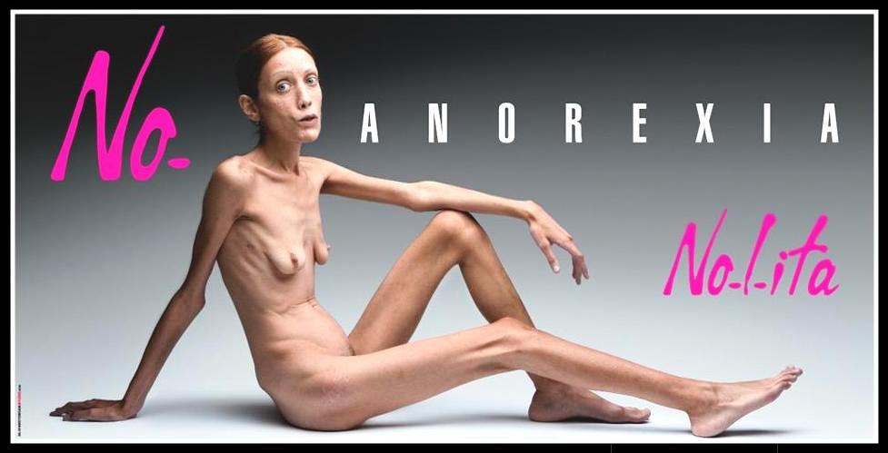 [anorexia.JPG]