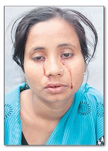 FiQ OnLinE: Gadis keluar air mata darah