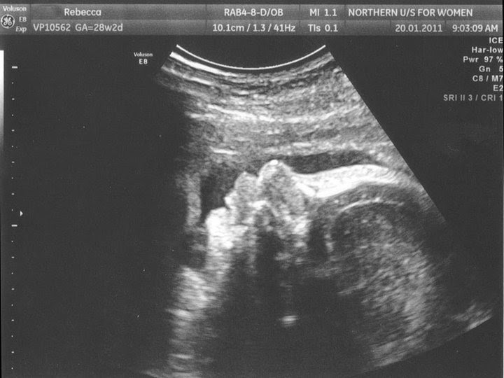 My Pregnancy Truths 28 Weeks (ultrasound pictures)