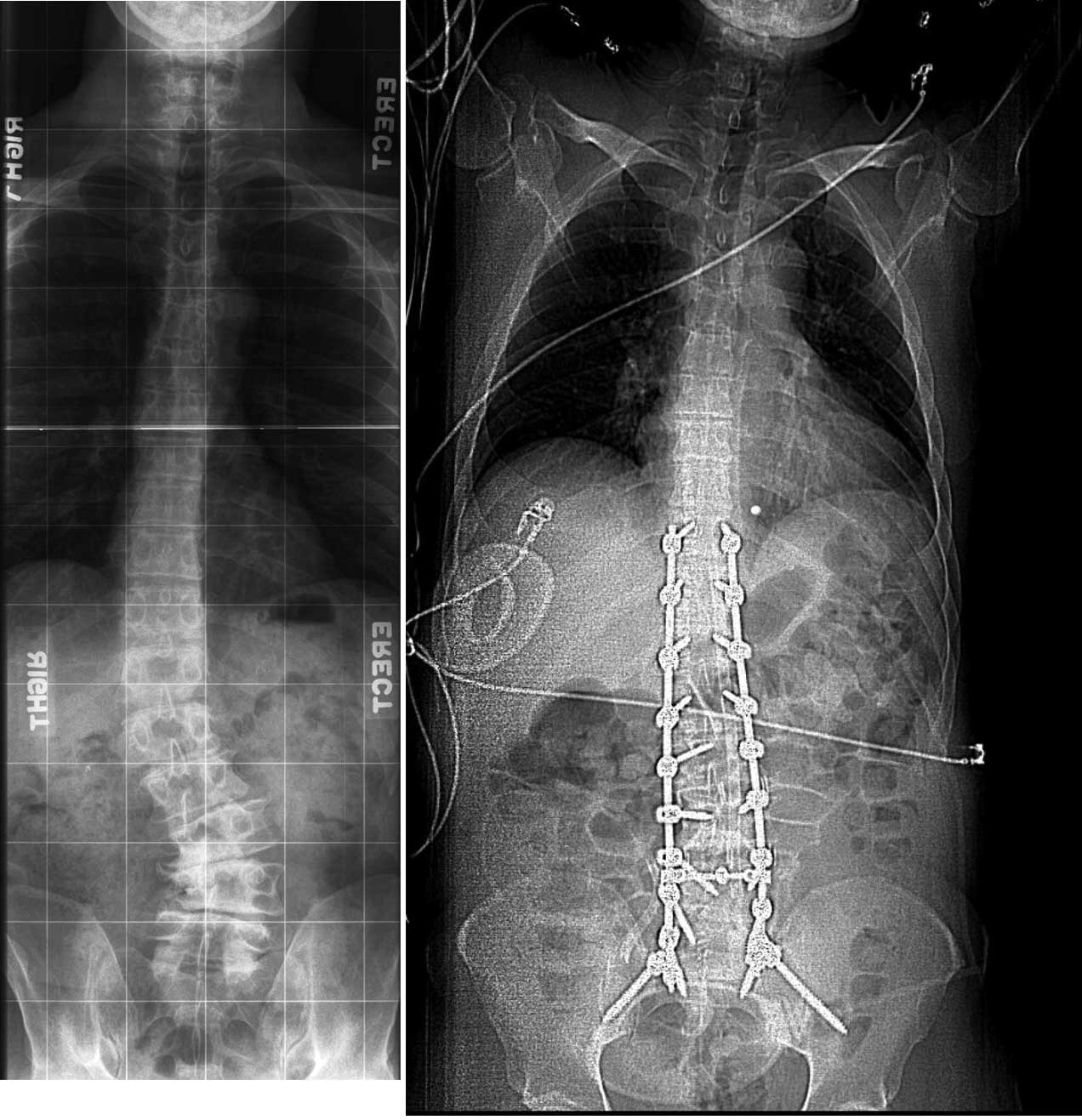 [combined-2-images.jpg]