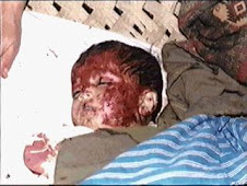 A Kashmiri Terrorist,11 months old ambushed Indian army