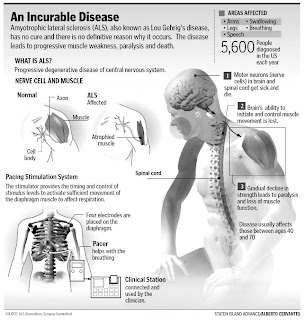 Findings point toward one of first therapies for Lou Gehrig’s disease