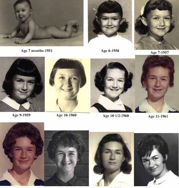 Hermaphrodites In Hollywood Born as a True Hermaphrodite Lynn Edward