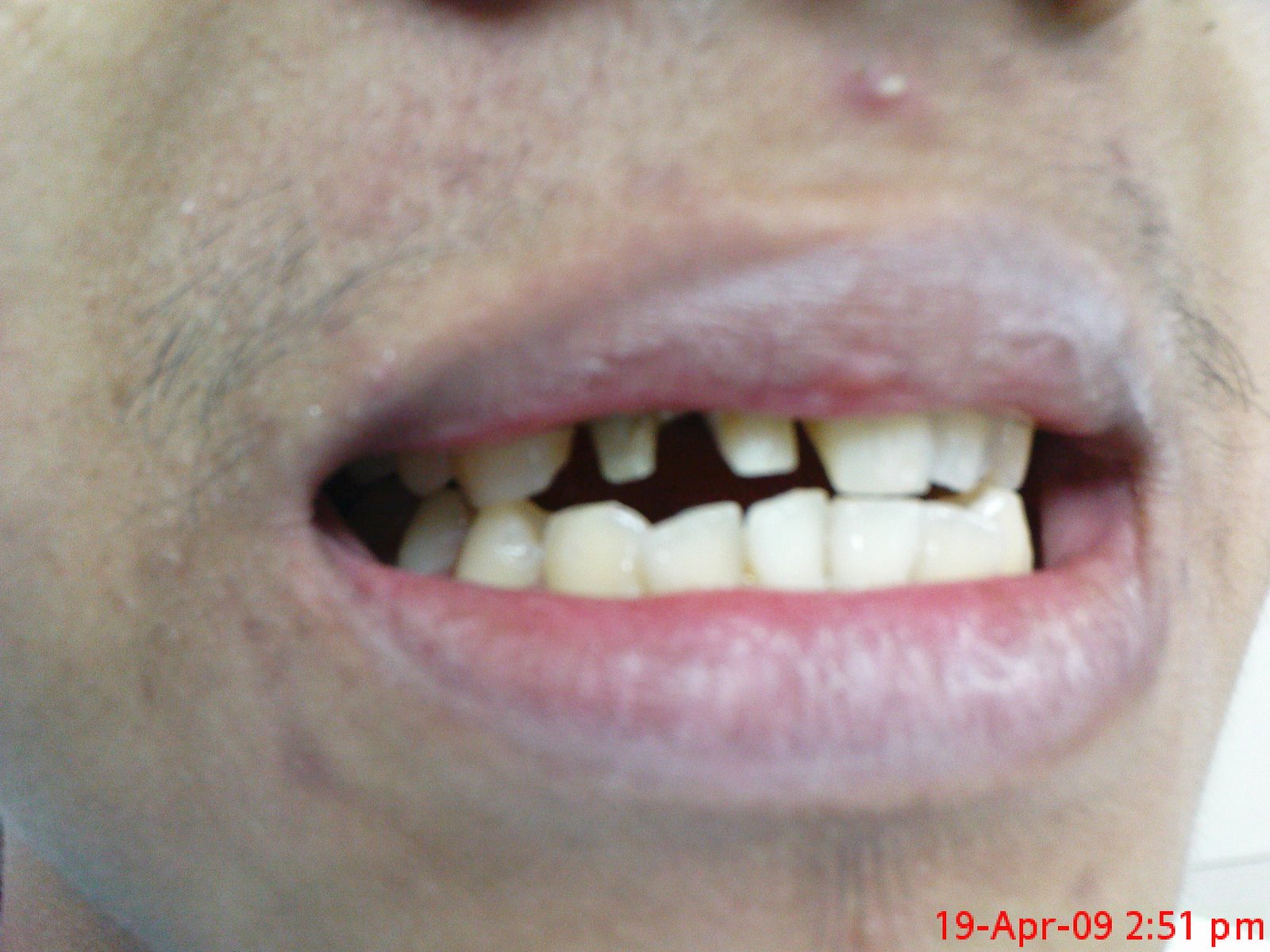 [DSC00215.JPG]
