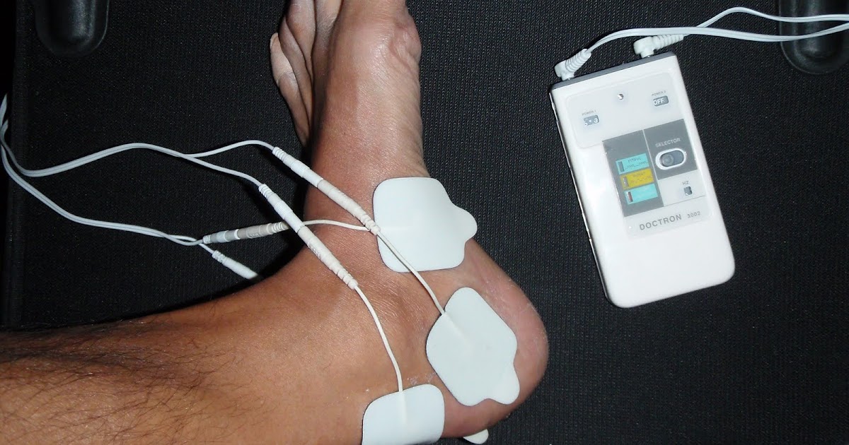 RunningShield Electronic Acupuncture