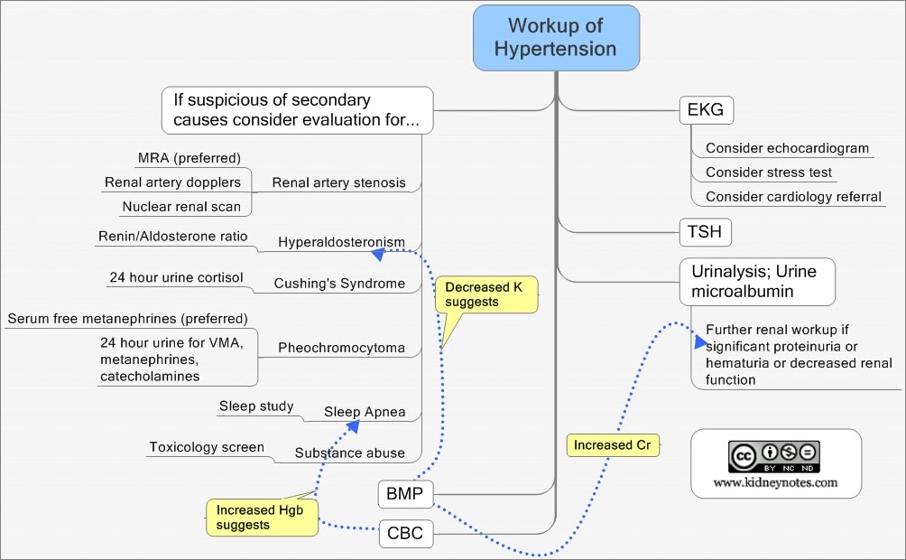 Kidney Notes Mindmap of the Workup of Hypertension (Primary and Secondary)