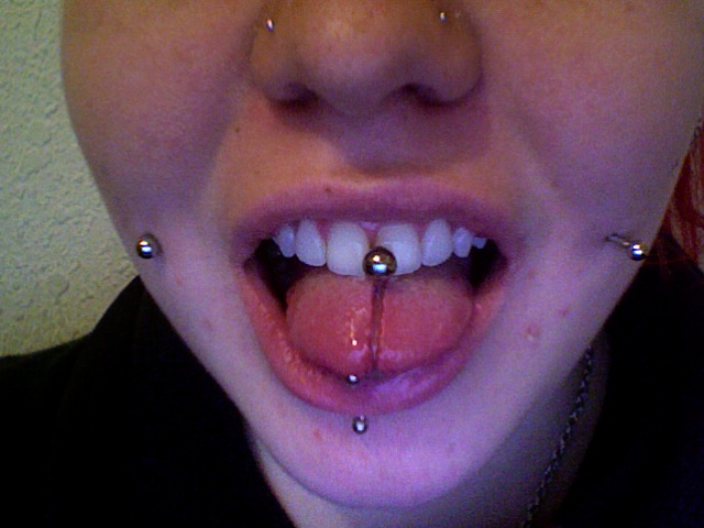 calculus buildup on bar of my tongue ring calculus buildup on bar of my tongue ring