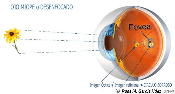 [67+Ojo+desenfocado.jpg]